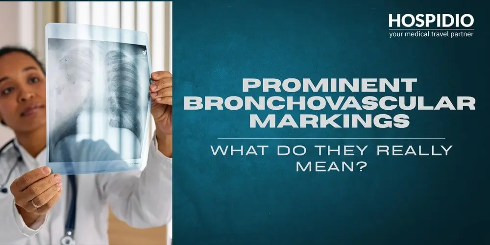 Prominent Bronchovascular Markings: What Do They Really Mean?