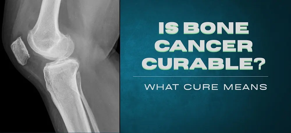 Is Bone Cancer Curable?