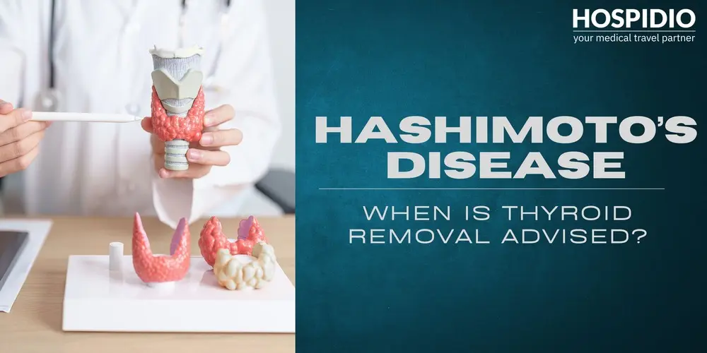 Hashimoto’s Disease Surgery: When Is Thyroid Removal the Right Option?