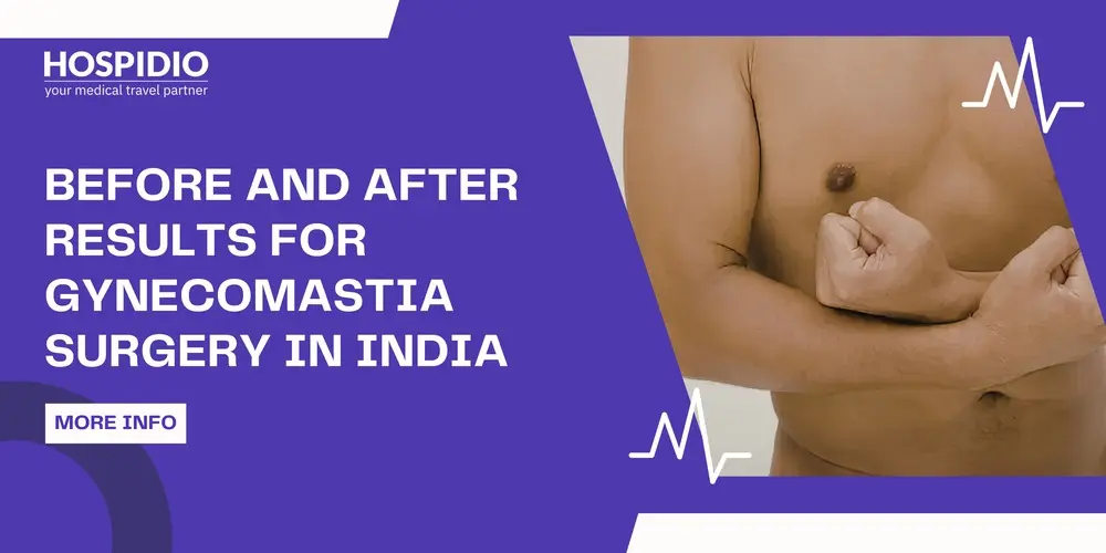 Before and After Results For Gynecomastia Surgery in India