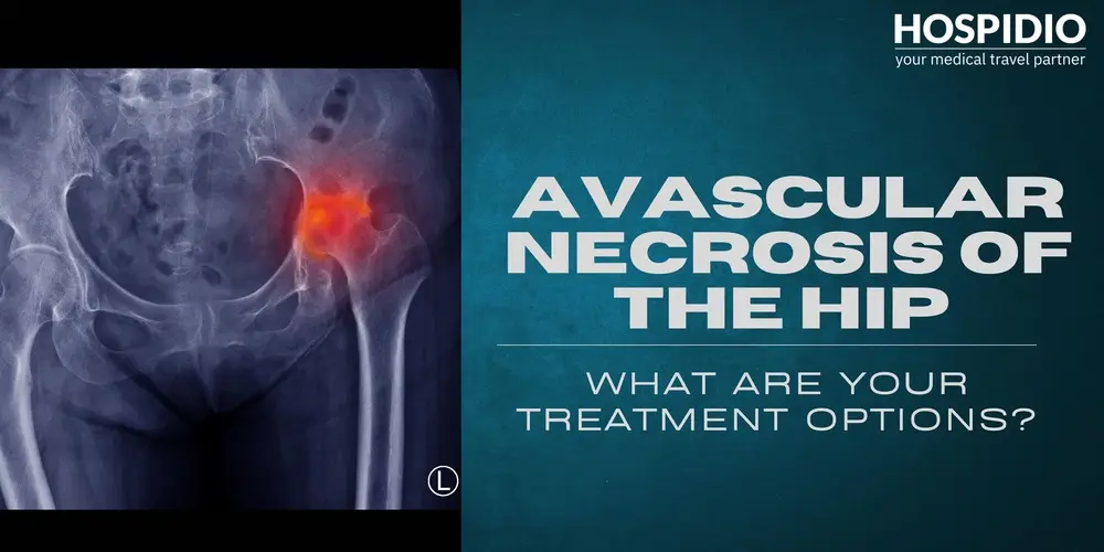 Avascular Necrosis of the Hip: Causes, Stages and Treatment Options Explained