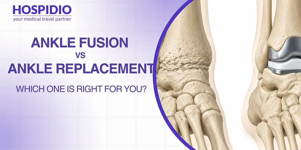 Ankle Fusion vs Ankle Replacement: Which One Is Right for You?
