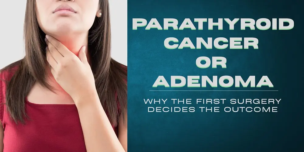 Parathyroid Cancer or Adenoma? Why the First Surgery Decides the Outcome